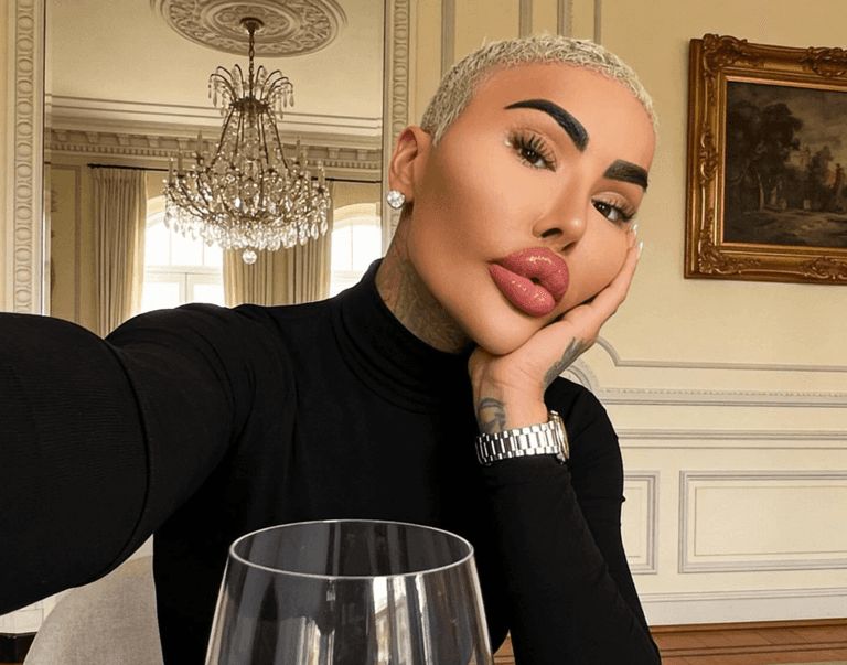 Jordan James Parke, qui avait dépensé plus de 120 000 euros en chirurgie esthétique pour ressembler à Kim Kardashian, décède des suites d'une intervention